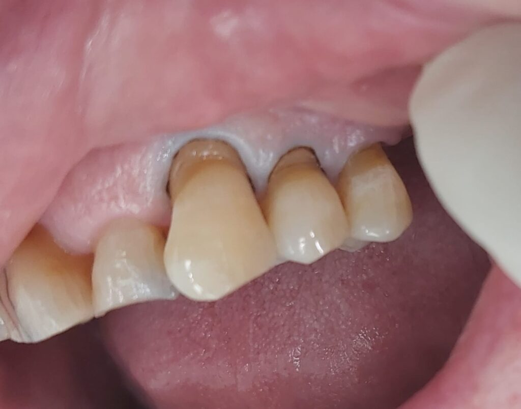 copia de caso dra bozhana antes