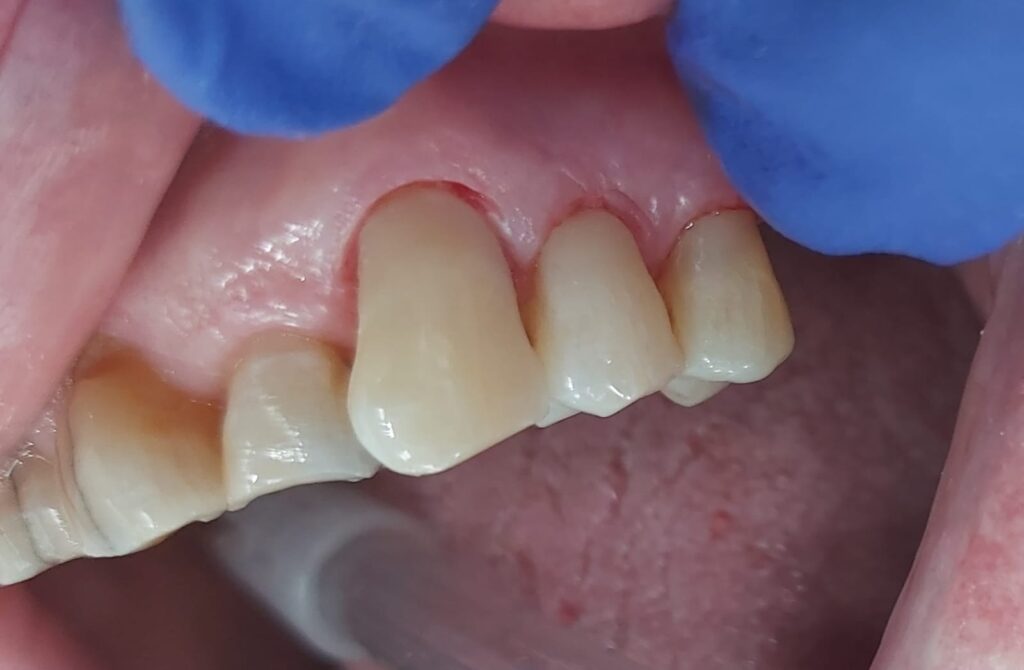 copia de caso dra bozhana después