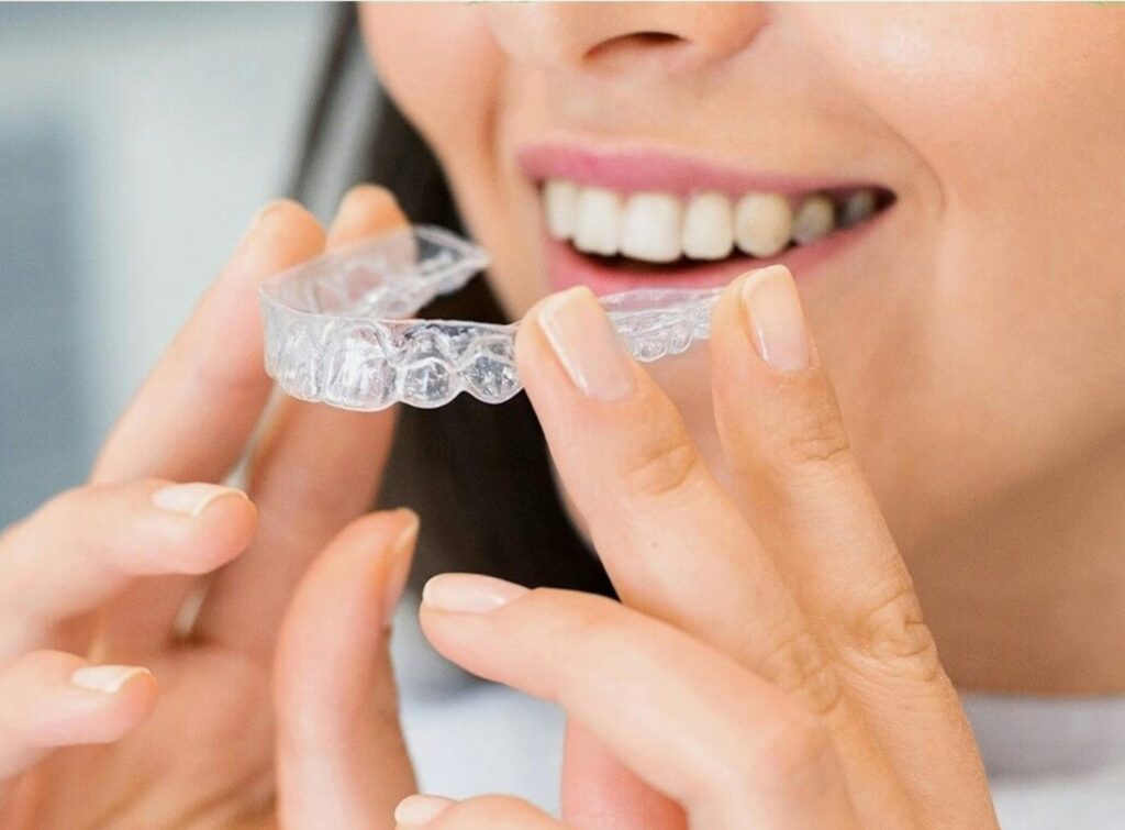 invisalign 1