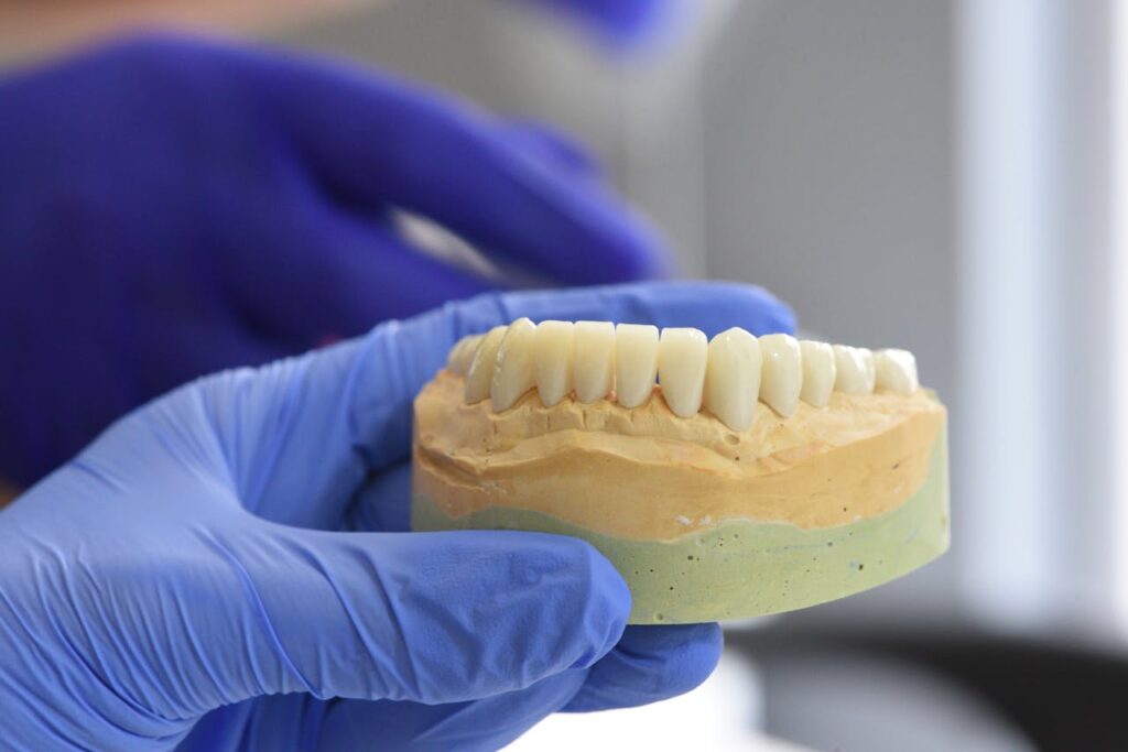 Implants dentals i Cirurgia Maxil·lofacial a Ripollet