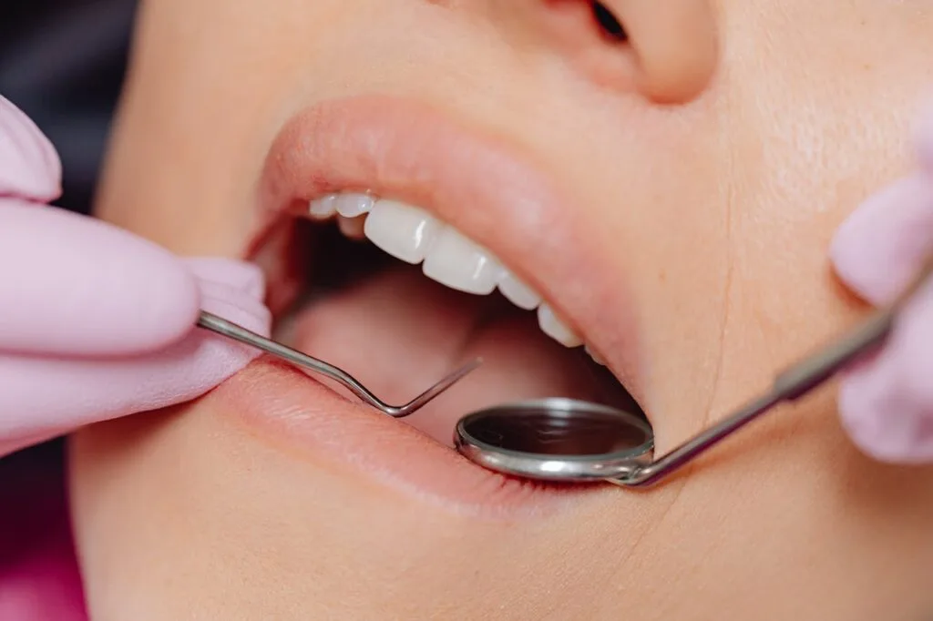 Detall primer pla d'una revisió dental amb mirall a la clínica Vallés Dental Detall primer pla d'una revisió dental amb mirall a la clínica Vallés Dental