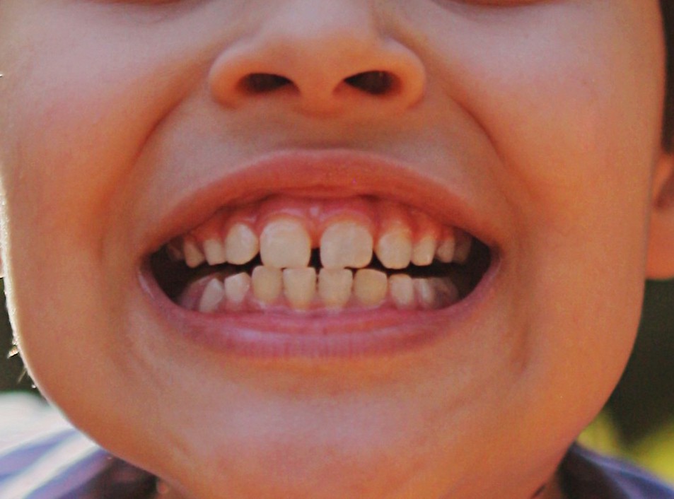 silvana carlos 4dvyxd3cdmg unsplash